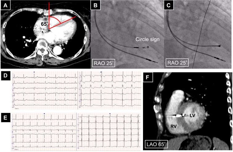 Figure 3