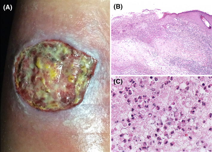 FIGURE 1