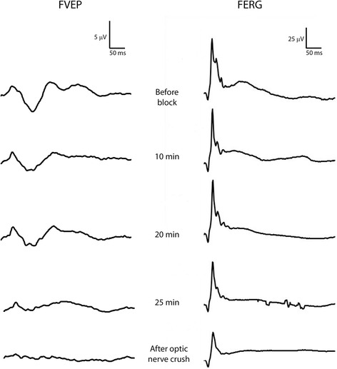 Fig. 10