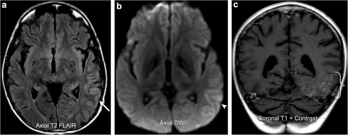 Fig. 15