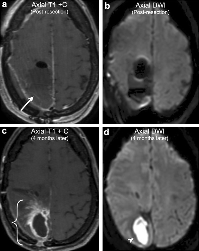 Fig. 18