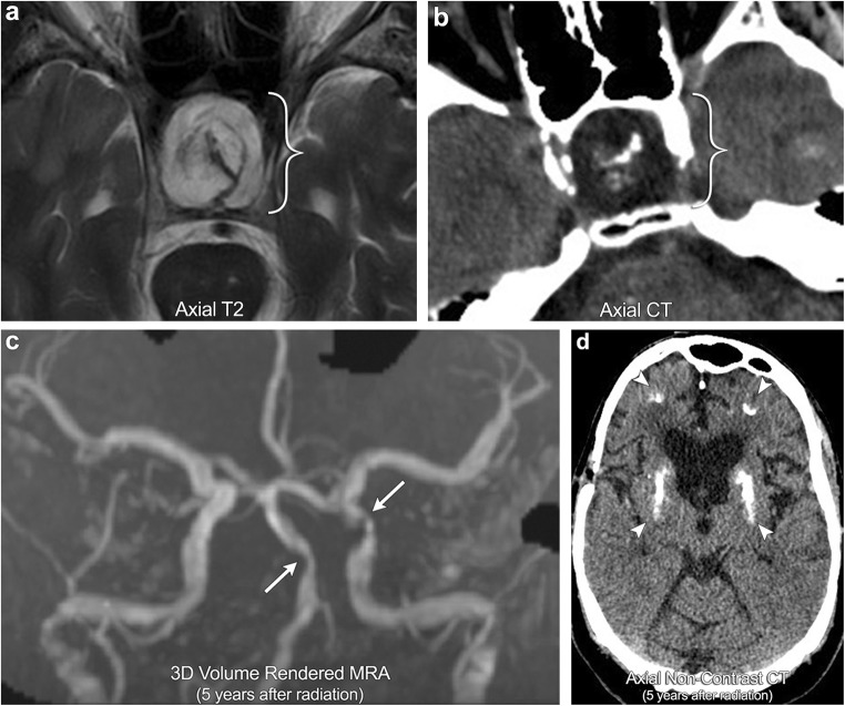 Fig. 11