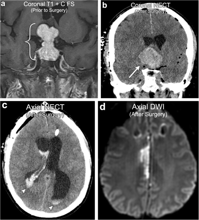 Fig. 17