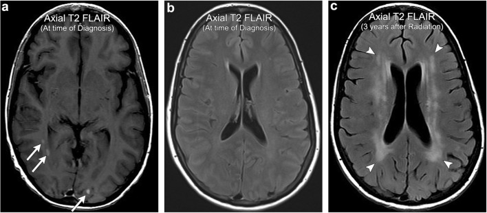 Fig. 14