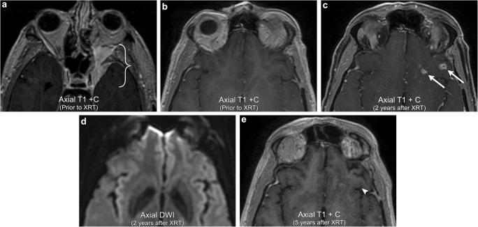 Fig. 13