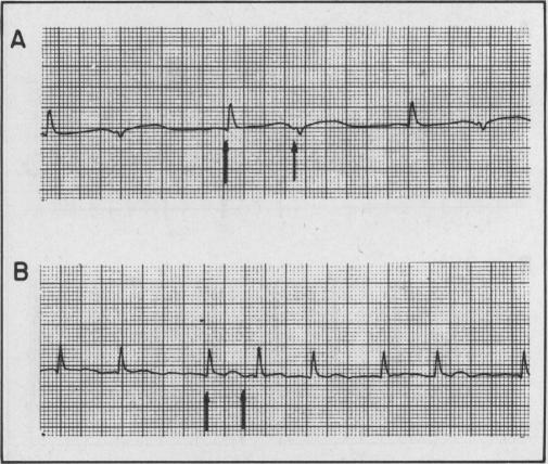 FIG. 6