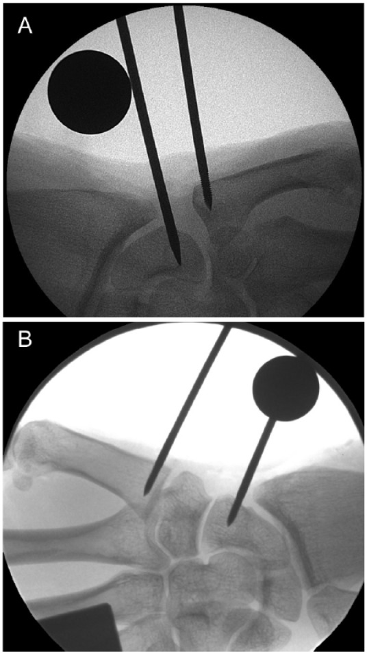 Figure 4.