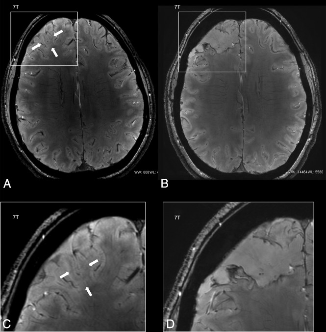 Fig 2.