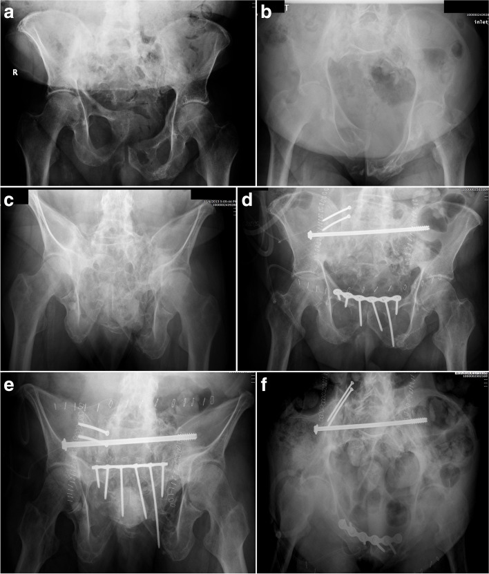 Fig. 10