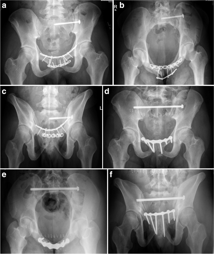 Fig. 11