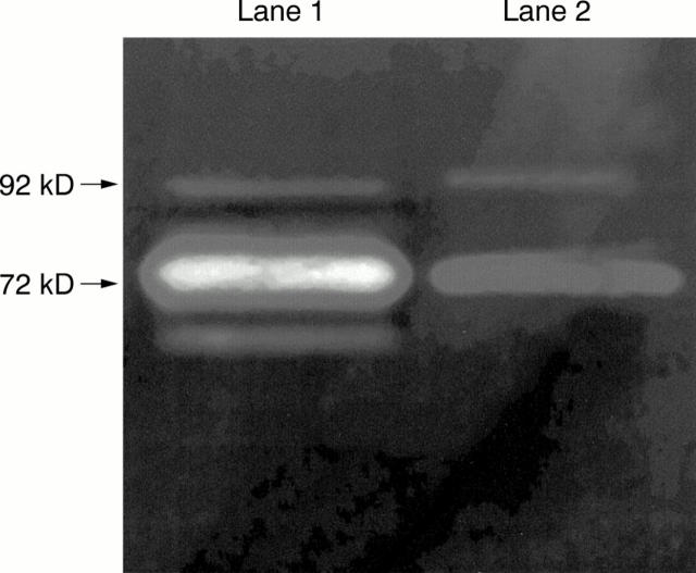 Figure 2  