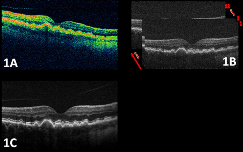 Figure 1