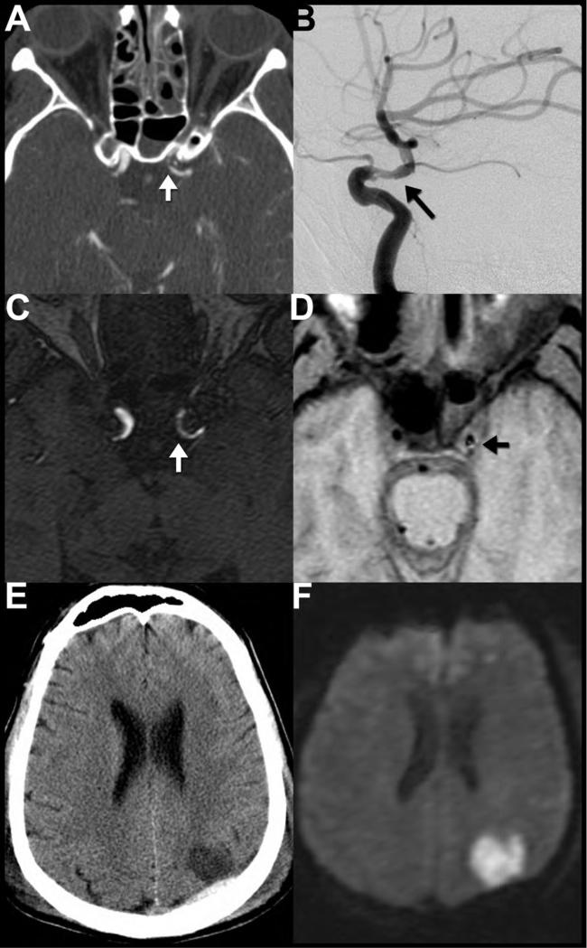 Figure 13