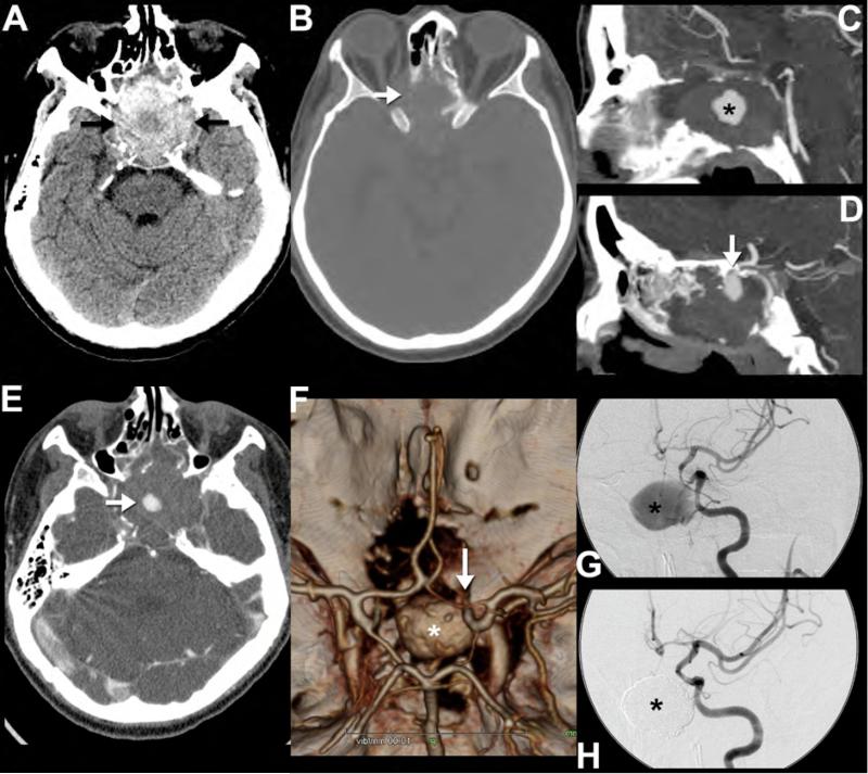 Figure 14