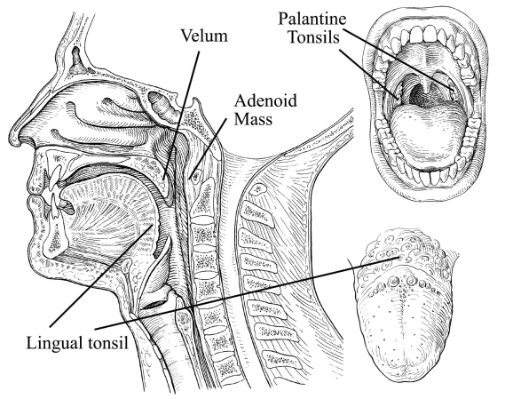 Fig. (6)