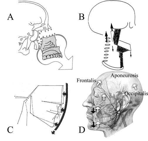 Fig. (1)