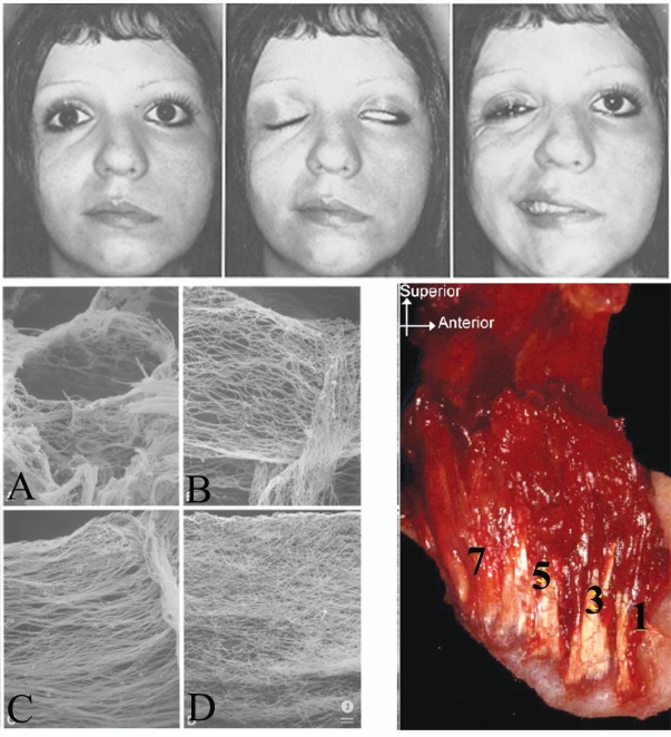 Fig. (5)