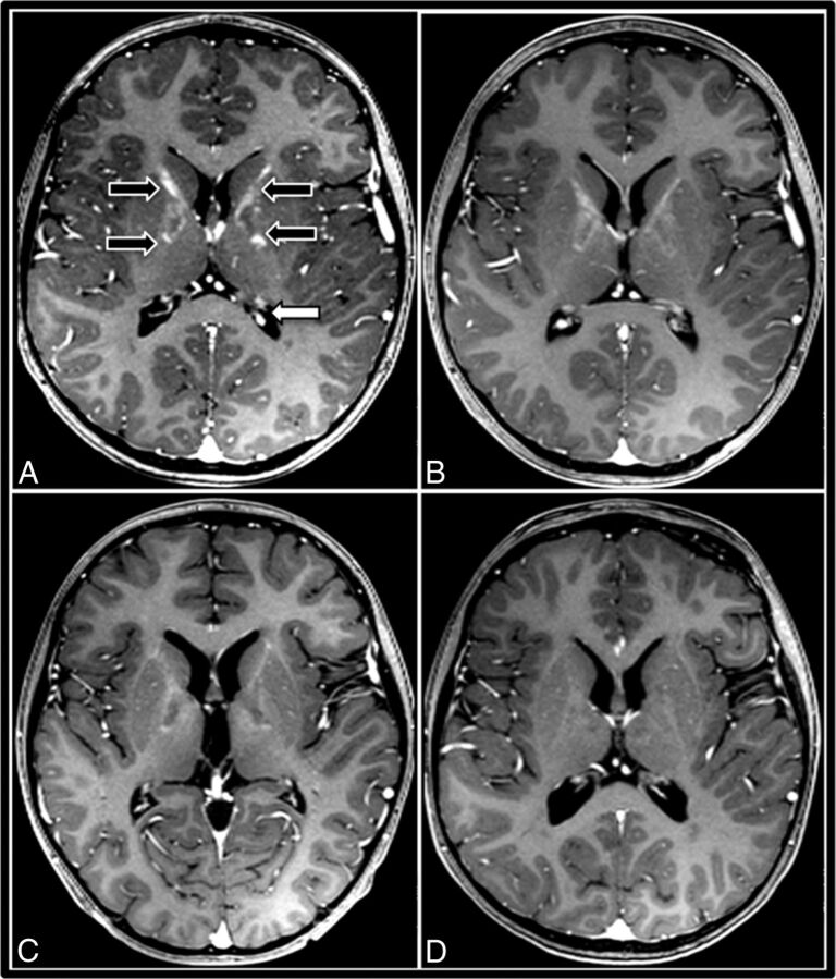 Fig 2.