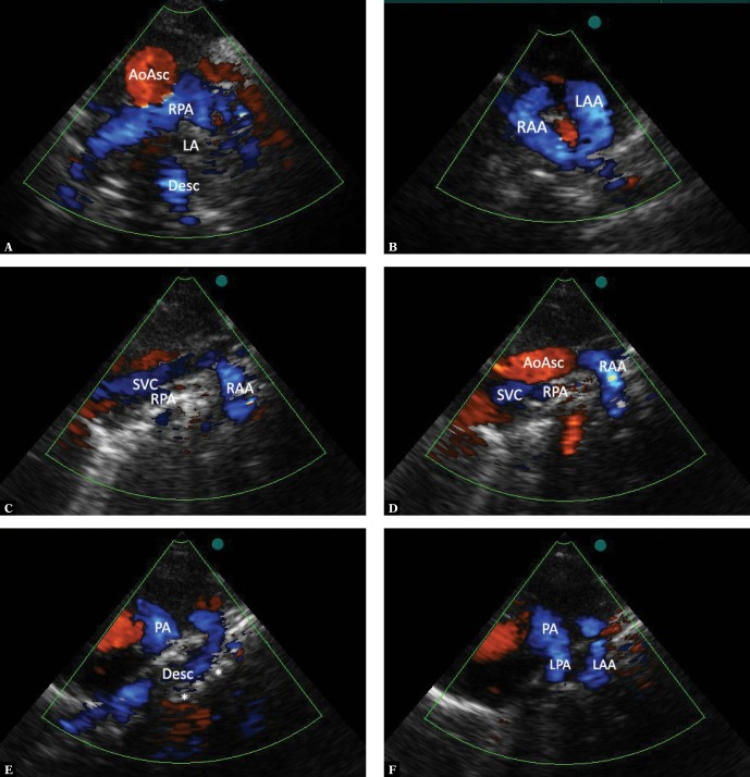 Fig. 14.