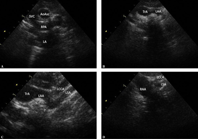 Fig. 15.