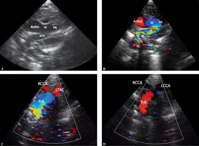 Fig. 13.