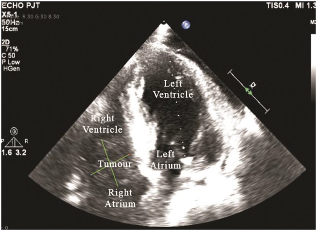 Figure 2