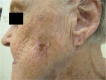 Figure 5A.