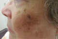Figure 1A.