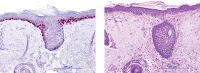 Figure 2D.