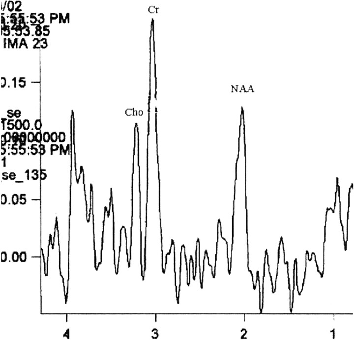 Fig 3.