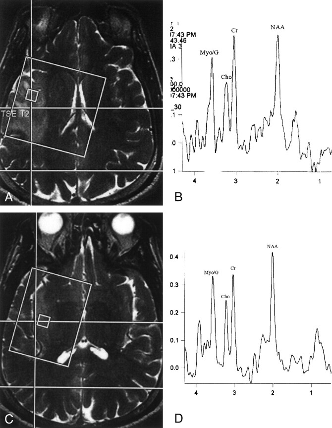 Fig 2.