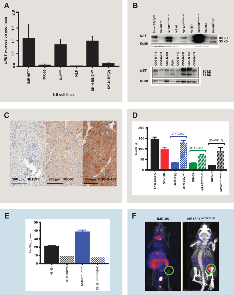 Figure 1. NET expression and NET-targeting radiotherapeutic uptake in neuroblastoma cell lines. A, RT-PCR of SLC6A (NET) expression in parental neuroblastoma cell lines and genetically modulated NET isogenic pairs. The geometric mean of SLC6A expression is normalized to housekeeping genes HPRT, TBP, and UBC. B, NET immunoblot for parental, isogenic cell lines and PDX models. Two separate bands are observed with the glycosylated form at 80 kD, and nonglycosylated band at 55 kD. C, NET IHC in neuroblastoma xenografts, NB1691, IMR-05, and COG-N-453x, showing that PDX models retain high expression. D, [131I]MIBG shows increased internalization in NET transfected cells compared with parental cells, mirroring NET expression as defined by RT-PCR. Differences in internalization between isogenic cell pairs was statistically significant. SK-N-BE(2)NET versus SK-N-BE (2) (P = 0.0002); IMR-05NET versus IMR-05 (P < 0.0001); NB1691NET/GFP/LUC versus NB1691 (P = 0.0013). E, [211At]MABG uptake in NB1691 cells with and without NET overexpression, with specificity demonstrated by desipramine blockade. F, SPECT/CT images obtained 24 hours after injection of 16.65 MBq (0.5 mCi) of [125I]MIBG showing localization in the high NET-expressing lentiviral transfected NB1691NET/GFP/LUC xenografts (right) as opposed to parental IMR-05 xenografts (left). Area of xenograft marked with green circles. Nonspecific bowel uptake is observed in the IMR-05 model.