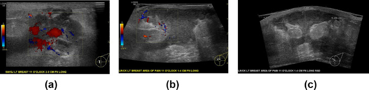 Fig 4 –