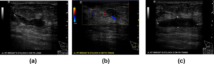 Fig 2 –