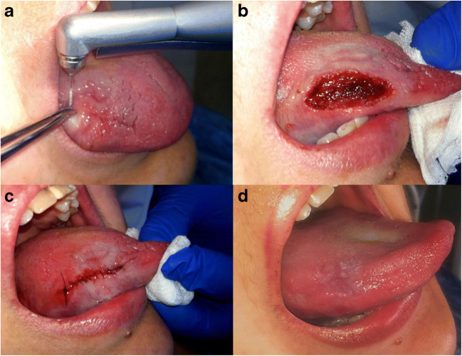 Fig. 2