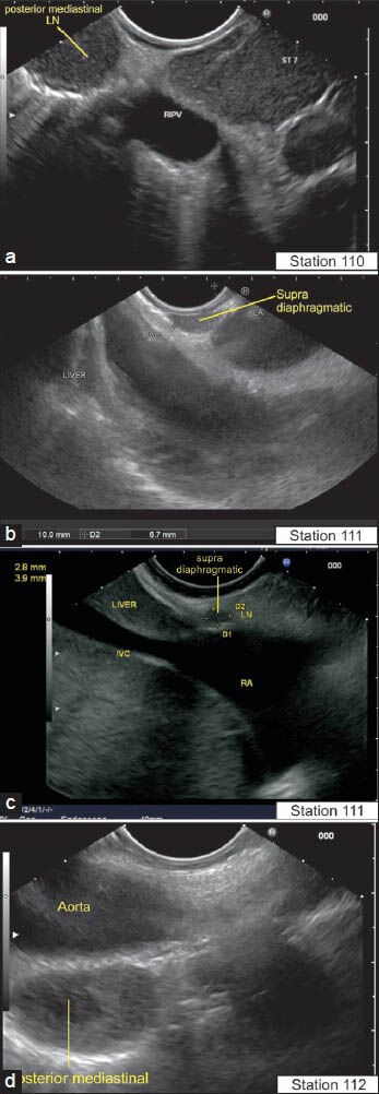 Figure 42