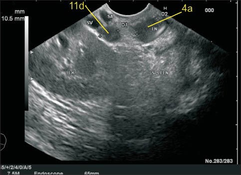 Figure 18