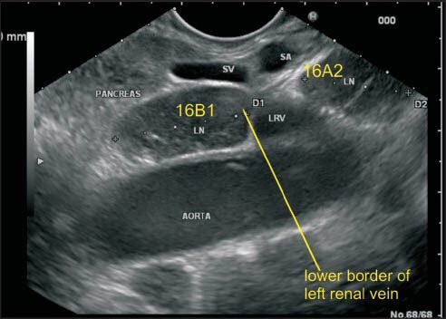 Figure 34