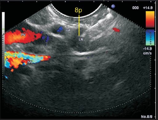 Figure 14