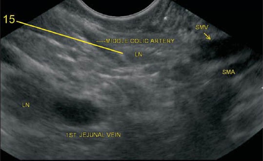 Figure 29b