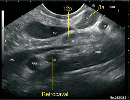 Figure 21