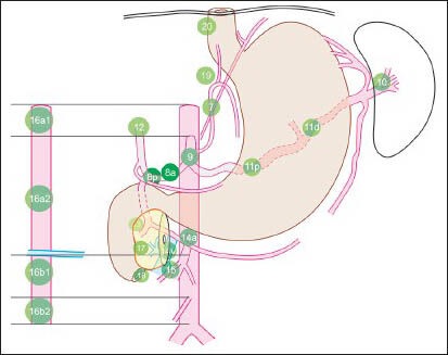 Figure 1b