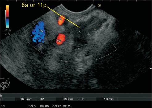 Figure 15