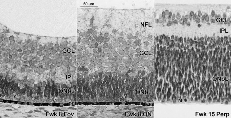 FIGURE 3