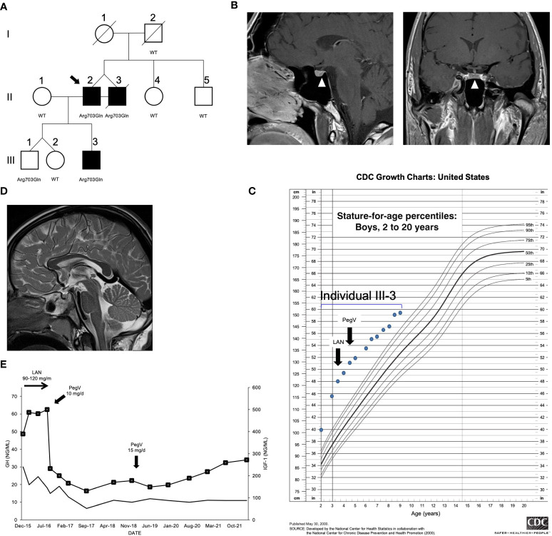 Figure 1