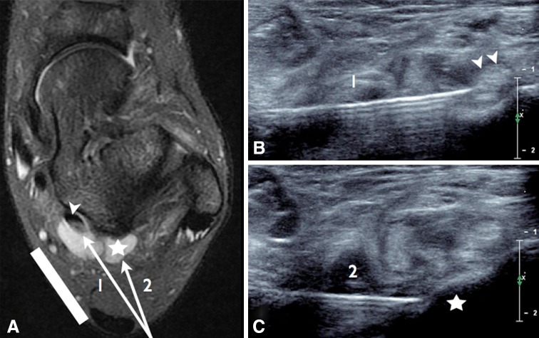 Fig. 9