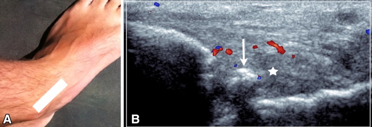 Fig. 6