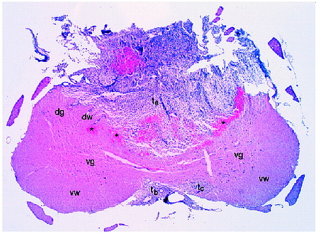 fig 2.