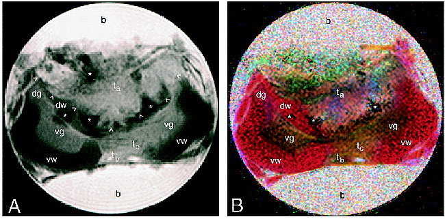 fig 1.