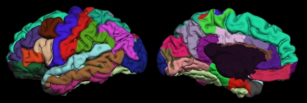 Figure 1b: